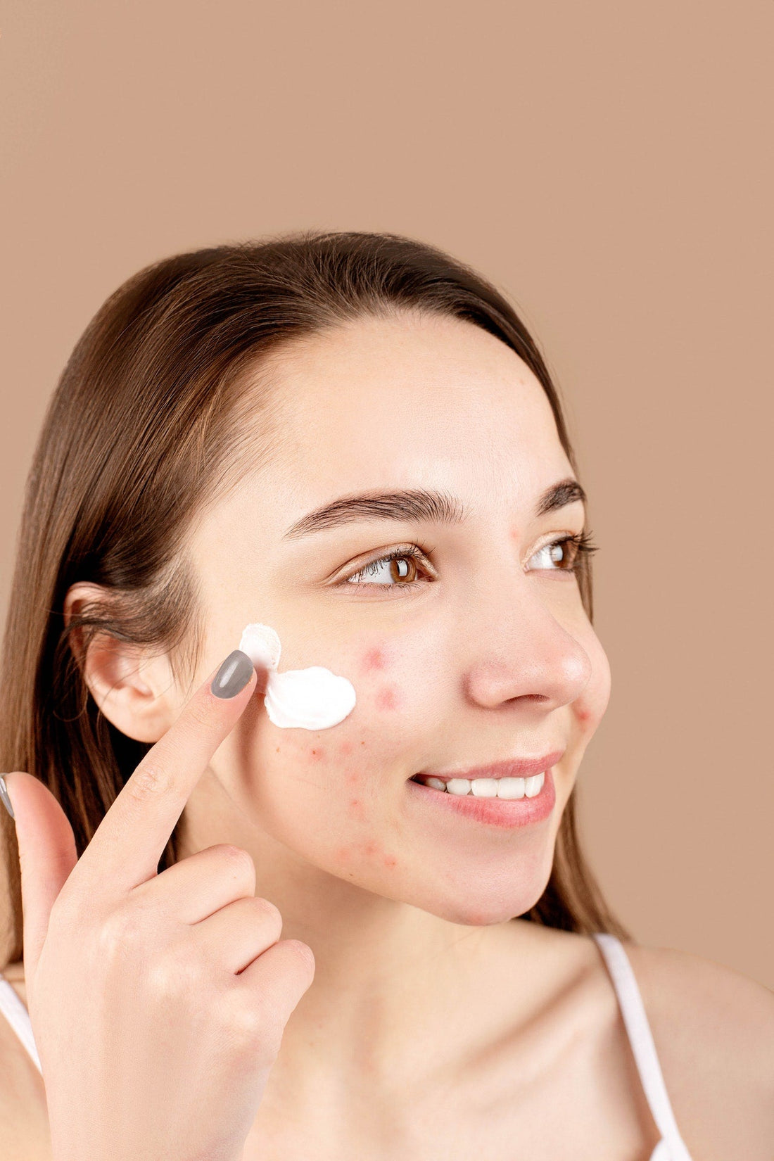 4 consigli su come trattare l'acne negli adulti | SINFONIE BOTANICHE